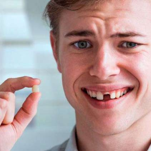 Knocked-Out Tooth - Dental Emergency Sign