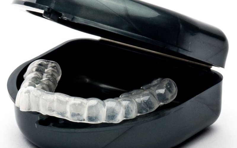 How a Custom Mouth Guard Is Made